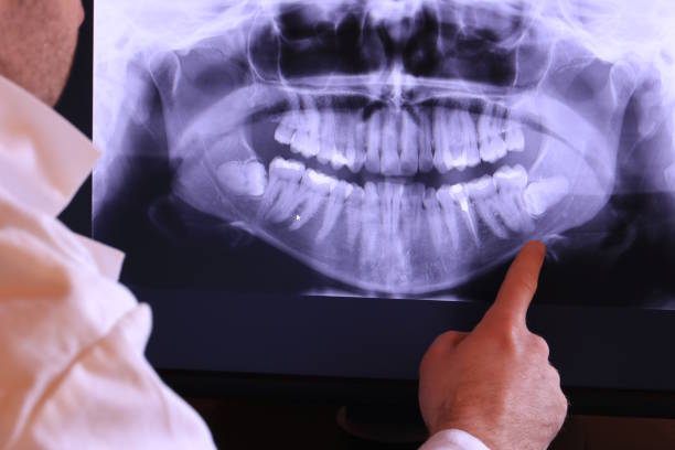 Best Emergency Treatment for Dental Infections or Abscesses in Venice, IL
